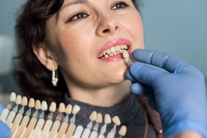 Implant dentaire : retrouver confort et esthétique dentaire !